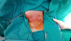 Hình ảnh tổn thương của bệnh nhân. Ảnh: Bệnh viện cung cấp
