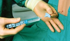 Gây tê tủy sống