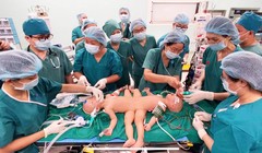 Gần 100 y, bác sĩ đang tiến hành phẫu thuật tách rời cặp song sinh Trúc Nhi – Diệu Nhi (Ảnh: Bệnh viện Nhi đồng Thành phố - TP. Hồ Chí Minh)