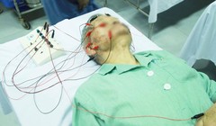 Bệnh nhân bị liệt mặt điều trị ở bệnh viện (Ảnh: BVCC)