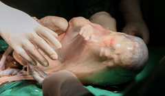 Bé trai thứ 2 của chị M. chào đời vẫn nằm nguyên trong bọc ối (Ảnh - BVCC) 