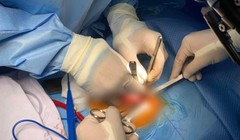 Các bác sĩ phẫu thuật cho bé (Ảnh - BVCC) 