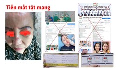 Trang facebook mạo danh Bệnh viện Trung ương Quân đội 108 khiến người dân "tiền mất, tật mang" (Ảnh - BVCC) 