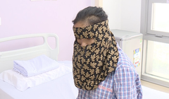 Cô gái có khối u khủng trên mặt (Ảnh - BVCC) 