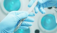 Ca phẫu thuật cấy ghép đầu được thực hiện thành công (ảnh minh họa).