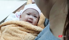 Hai bé song sinh dính liền gan tại Bệnh viện Nhi đồng 1 được xuất viện