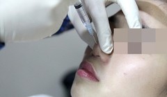 Thêm 1 tai nạn thẩm mỹ nghiêm trọng trên địa bàn TP.HCM