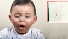 Bé gái hơn 1 tuổi nuốt cây tăm dài 5cm vào dạ dày. Ảnh minh họa