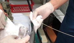 Một phần con sán dây bò được lấy ra khỏi tá tràng của bệnh nhân. Ảnh: BVCC