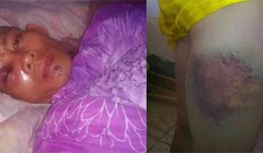 Ông Đậu Hoàng Anh (ảnh trái) và chân anh Đào Ngọc Cường (ảnh phải) có chủ sử dụng lao động là Công ty TNHH xây dựng công trình Đông Nhất Giang Tô (Trung Quốc) có trụ sở tại Algeria bị đánh bầm dập. Ảnh: Công nhân cung cấp cho báo chí