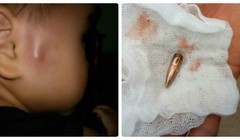 Cháu bé ở trường mầm non Họa Mi - thị trấn Gia Khánh - bị đạn bắn trúng. Ảnh: VTV 