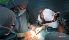 Bác sĩ BV Nhi đồng 1 phẫu thuật tách cặp em bé song sinh dính liền gan