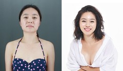 Người Hàn Quốc có quan niệm rắt cởi mở về phẫu thuật thẩm mỹ. Nguồn: Business Insider