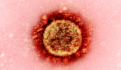 Công nghệ CRISPR làm ngưng sự lan truyền của virus Corona trên người (Ảnh: Free Think)