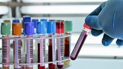 Các nhà khoa học phát hiện 2 nhóm máu mới