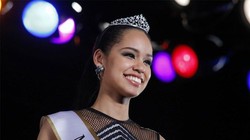 Hoa hậu Hoàn vũ 2015 Ariana Miyamoto - Ảnh chụp màn hình abcnews