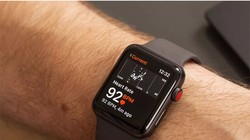 Apple Watch (ảnh: The Verge)