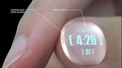 Ảnh minh họa (theo Brightside)