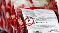 Ảnh minh họa (theo Brightside)