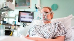 Đại học London (UCL) công bố bức ảnh một bệnh nhân tình nguyện dùng dụng cụ trợ thở do UCL phối hợp với các kỹ sư, bác sĩ và đội đua Công thức 1 Mercedes phát triển chưa tới 1 tuần - Ảnh: AFP