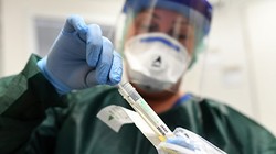 Bộ kit thử nhanh của Trung Quốc có độ chính xác thấp gây tranh cãi ở một số quốc gia (Ảnh: AFP).