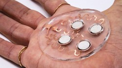 Miếng dán siêu âm cho phép vận chuyển thuốc qua da. Ảnh MIT.