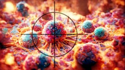 Công ty NuTek phát triển Rainbow Probe, máy quét cầm tay phát hiện tế bào ung thư thời gian thực trong phẫu thuật. Ảnh minh họa NoCamels