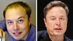 Sự khác biệt rõ rệt của Elon Musk. Ảnh: Business Insider.