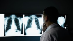 Hình minh họa: iStock/diego_cervo