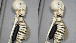 Cơ bắp nhân tạo được sử dụng để nâng cánh tay của bộ xương lên 90 độ. Ảnh: Aslan Miriyev/Columbia Engineering.