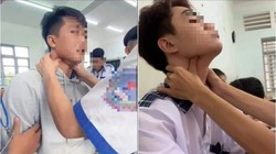 Bác sĩ cảnh báo: Trò “bắt pen” ở giới trẻ cực nguy hiểm, có thể gây tử vong