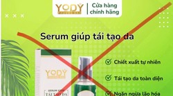 32 lô mỹ phẩm của Công ty dịch vụ thẩm mỹ Yody Phương Anh bị thu hồi
