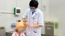 Bé gái 5 tuổi bị chó cắn 10 vết ở đầu, mặt