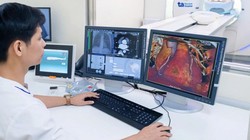 "Đau ngực đột ngột, đừng chần chừ - tín hiệu cứu mạng khi bị nhồi máu cơ tim”