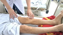 Giun chó mèo “ăn” vào não vì nuôi thú cưng bẩn, ăn uống nguy hiểm