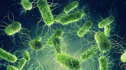 Nguy cơ dịch tả toàn cầu và bài học cảnh giác cho Việt Nam