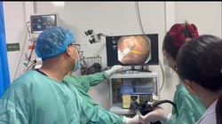 Chiếc tăm 7cm cắm sâu trong dạ dày, bệnh nhân thoát chết trong gang tấc 