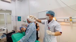 Cụ ông 88 tuổi co giật, hoại tử da đầu vì đắp lá chữa zona