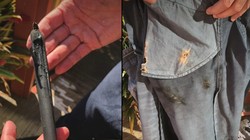  iPhone X phát nổ trong túi quần