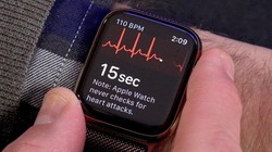 Apple Watch tại Việt Nam sẽ đo được điện tâm đồ