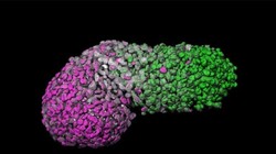 Nhóm nghiên cứu cho biết mô hình bào thai có thể cung cấp những cái nhìn sâu sắc về một số dị tật bẩm sinh. Ảnh: News Info Park