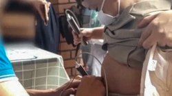 Nhân viên cơ sở y tế sử dụng "bút đo vi chất" đối với bệnh nhân nhi (ảnh chụp màn hình)