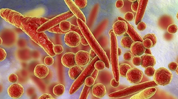 Viêm phổi do Mycoplasma là một bệnh nhiễm trùng ở phổi khá phổ biến