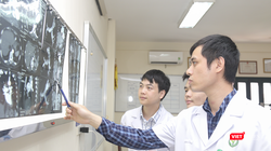 CÁc bác sĩ Bệnh viện Hữu nghị Việt Đức chẩn đoán hình ảnh đối với ca bệnh của bệnh nhân H.