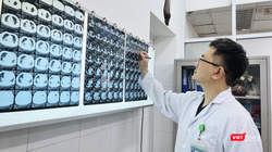 BSCKII Thân Trọng Vũ - Trưởng khoa Ngoại lồng ngực, Bệnh viện Đà Nẵng, phẫu thuật viên chính của ê kíp mổ - chẩn đoán hình ảnh của bệnh nhân