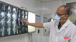 PGS.TS. Nguyễn Hồng Hà - Trưởng khoa Phẫu thuật Hàm mặt, Tạo hình và Thẩm mỹ, Bệnh viện Hữu nghị Việt Đức chẩn đoán hình ảnh bệnh lý của bệnh nhân