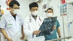 PGS.TS. Mai Duy Tôn - Giám đốc Trung tâm Đột quỵ, Bệnh viện Bạch Mai (đứng giữa) đang thăm khám cho bệnh nhân