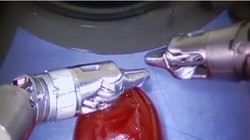 Video: Robot siêu công nghệ Da Vinci khâu được cả vỏ quả nho