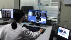 Dịch vụ chuẩn đoán bệnh sử dụng AI và Đám mây. Ảnh Nikkei Asia.