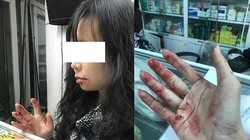 Chị N.D sau khi bị tài xế Uber hành hung (ảnh do nhân vật cung cấp)